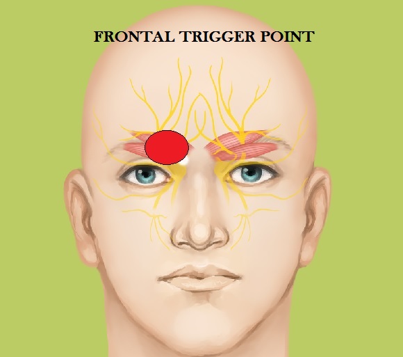 FRONTAL TRIGGER.jpg